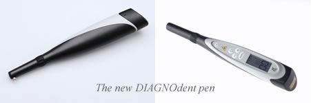 DIAGNOdent pen